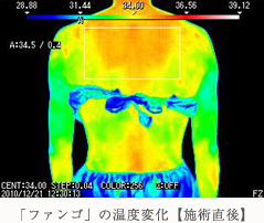 「ファンゴ」の温度変化【施術直後】